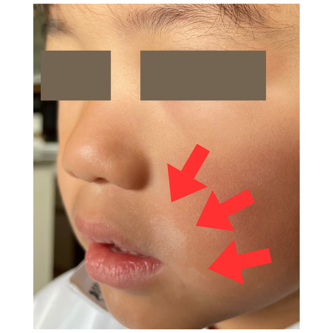 顔の白い斑点はなぜできる？放置厳禁の真相と見分け方を皮膚科医が徹底解説