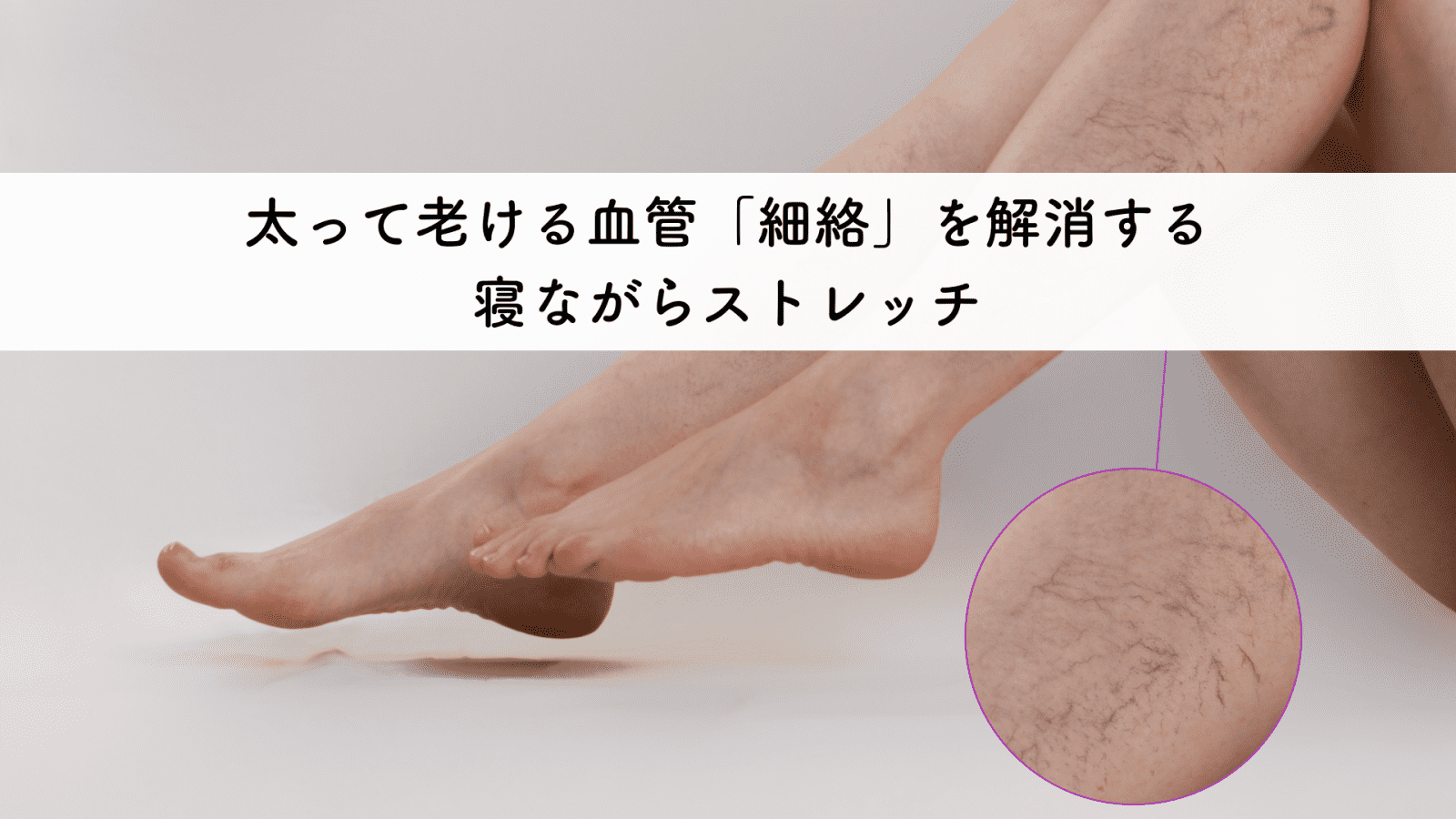 足やくるぶしの紫血管「細絡」とは？瘀血の危険サインと最新治療法