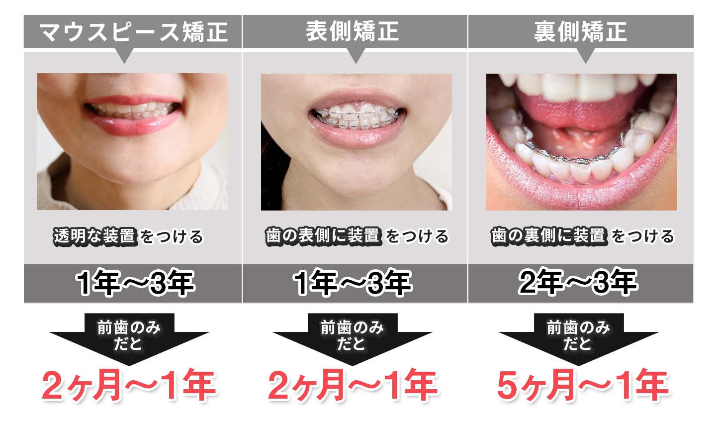 マウスピース矯正で顔が変わる？輪郭変化と頬こけの真相【2026最新】
