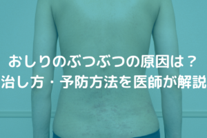 【真相】 おしり の ブツブツ 治す 方法 最新写真集＆動画まとめ #671