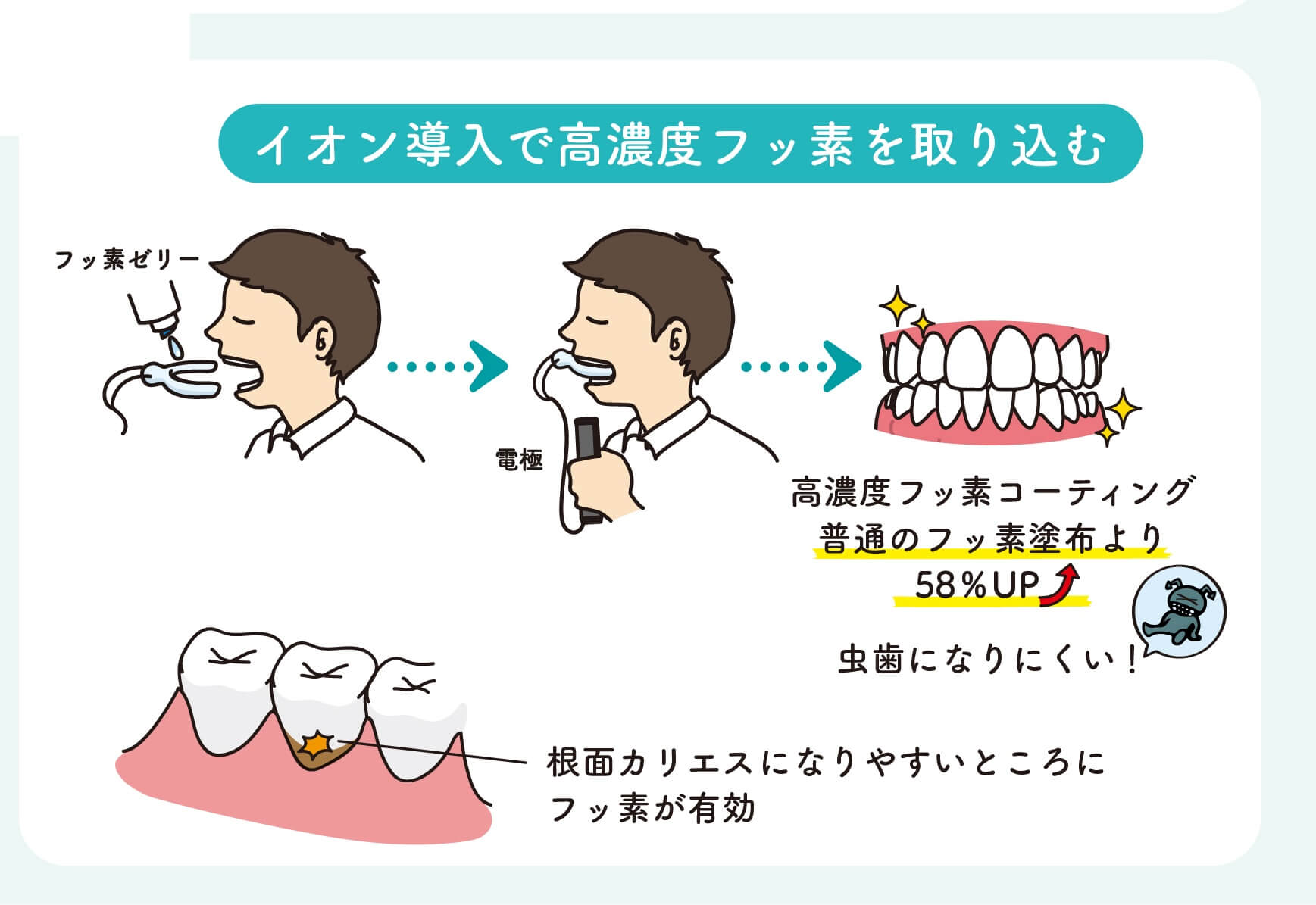 歯医者のフッ酸誤塗布事件の真相｜劇薬事故の経緯と現代の安全性