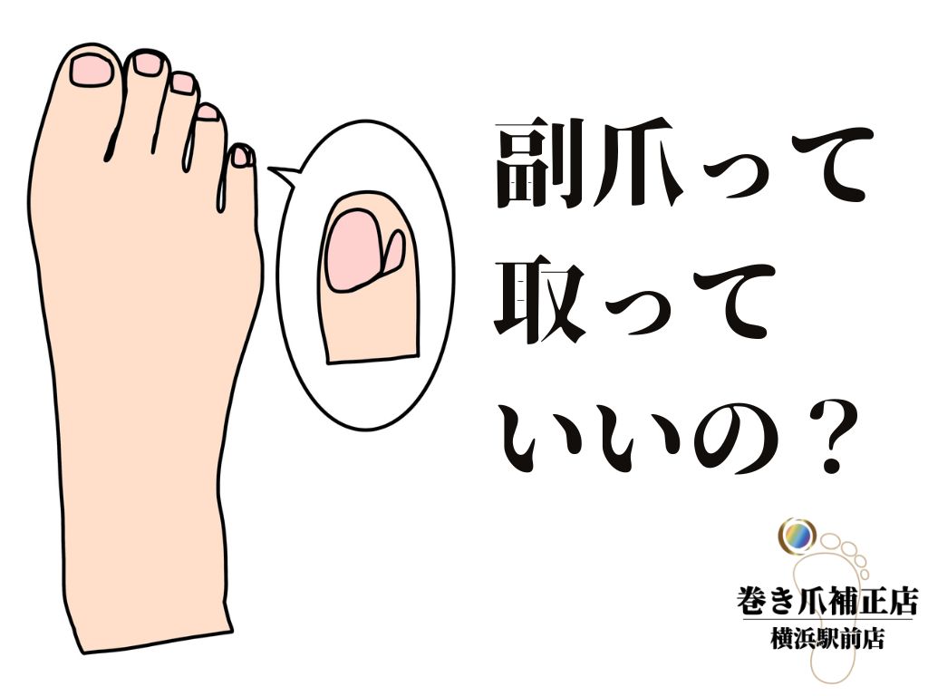 副爪を引っこ抜く激痛と化膿の真相！皮膚科の治療と自宅ケア完全ガイド