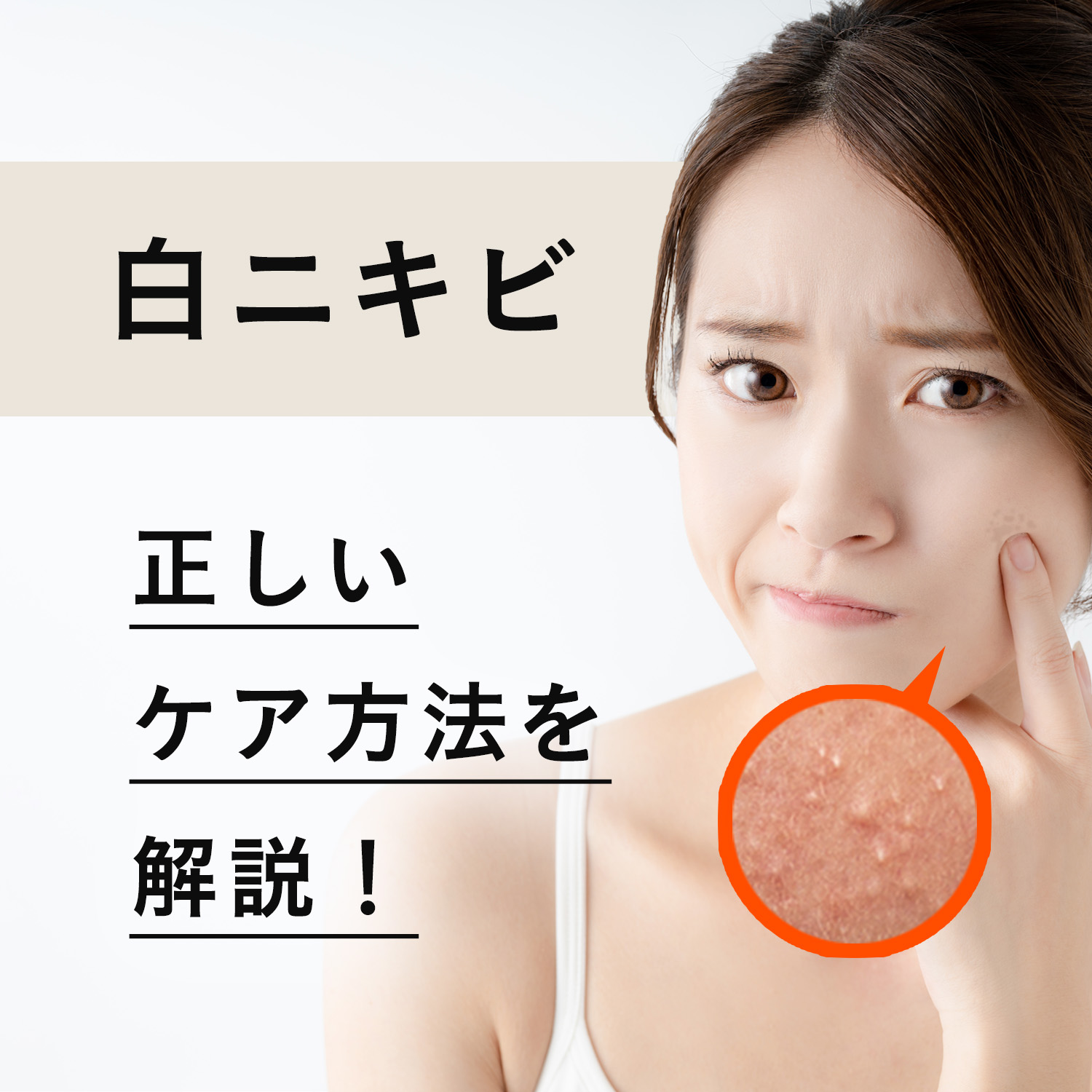 白ニキビの即効治し方完全ガイド｜潰さず一晩で鎮静させる最新スキンケア