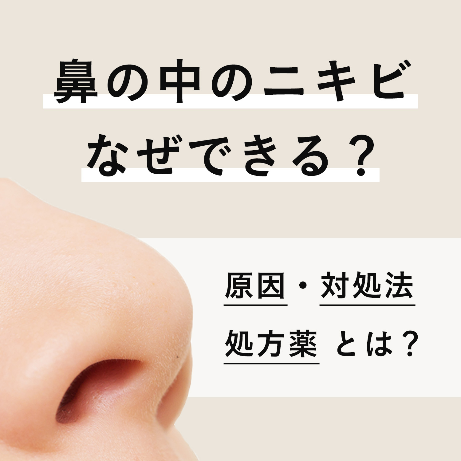 鼻の中のニキビがズキズキ痛い！面疔の危険性と正しい治し方・市販薬