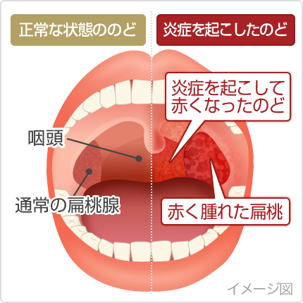 【速報】 朝起き たら 喉 が 痛い 最新ニュース速報 2026 #871
