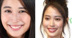 【画像あり】 広瀬 アリス 顔 変わっ た 最新情報まとめ 2026 #974
