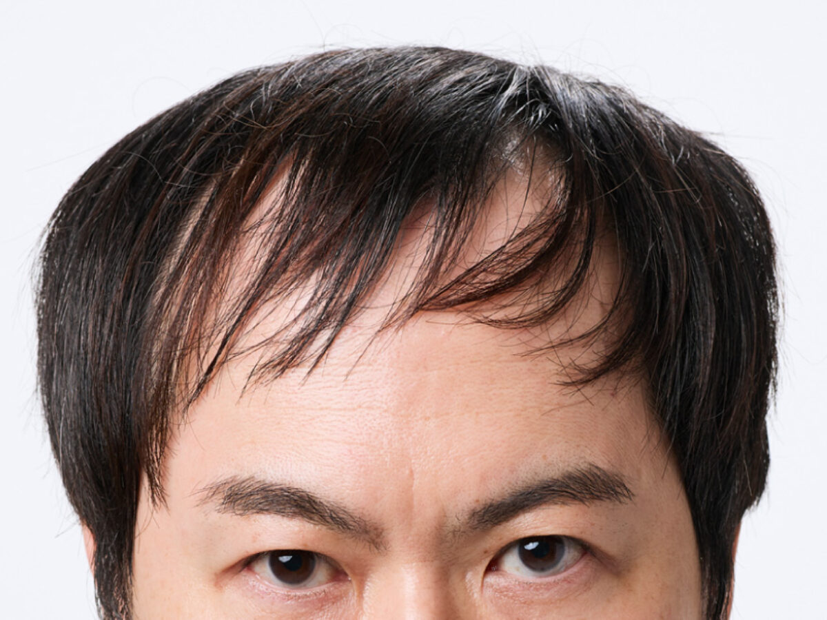 前髪が薄い男の髪型は隠すな！2026年最新短髪セット術と失敗回避策
