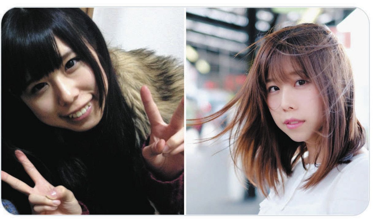有村藍里の整形前と現在の劇的変化｜骨切り手術の真相と2026年最新の姿