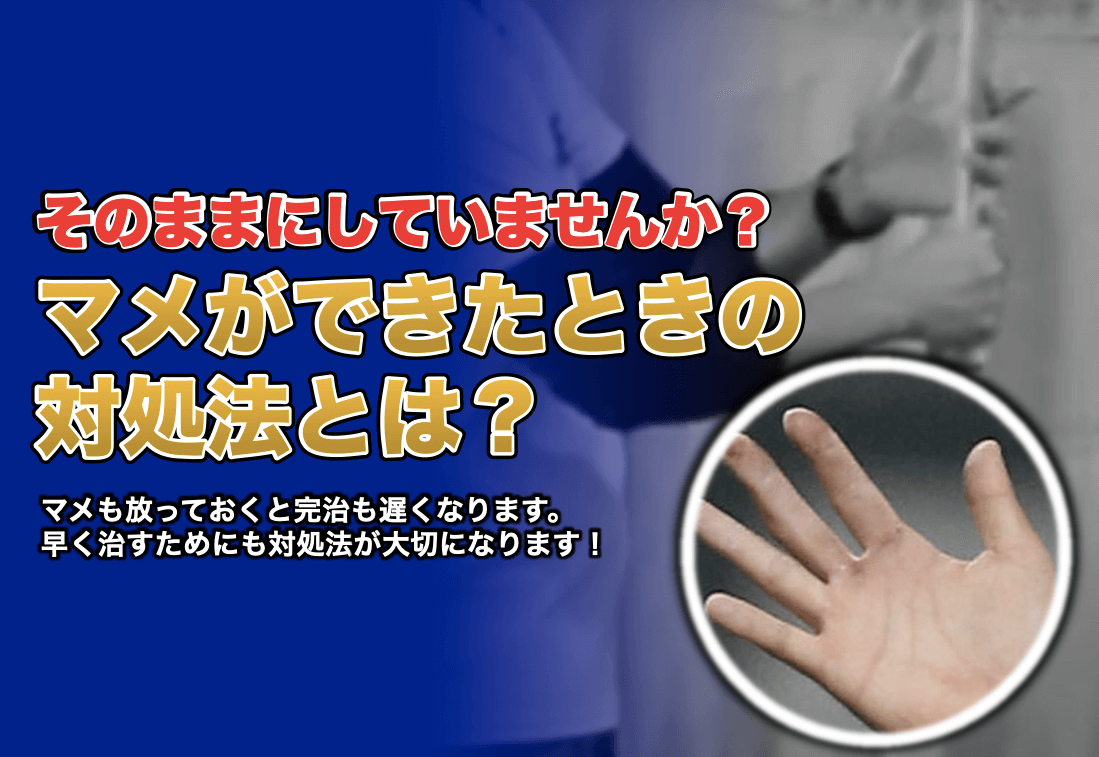 手のマメを早く治す方法｜潰すのはNg？激痛を即緩和する湿潤療法の極意