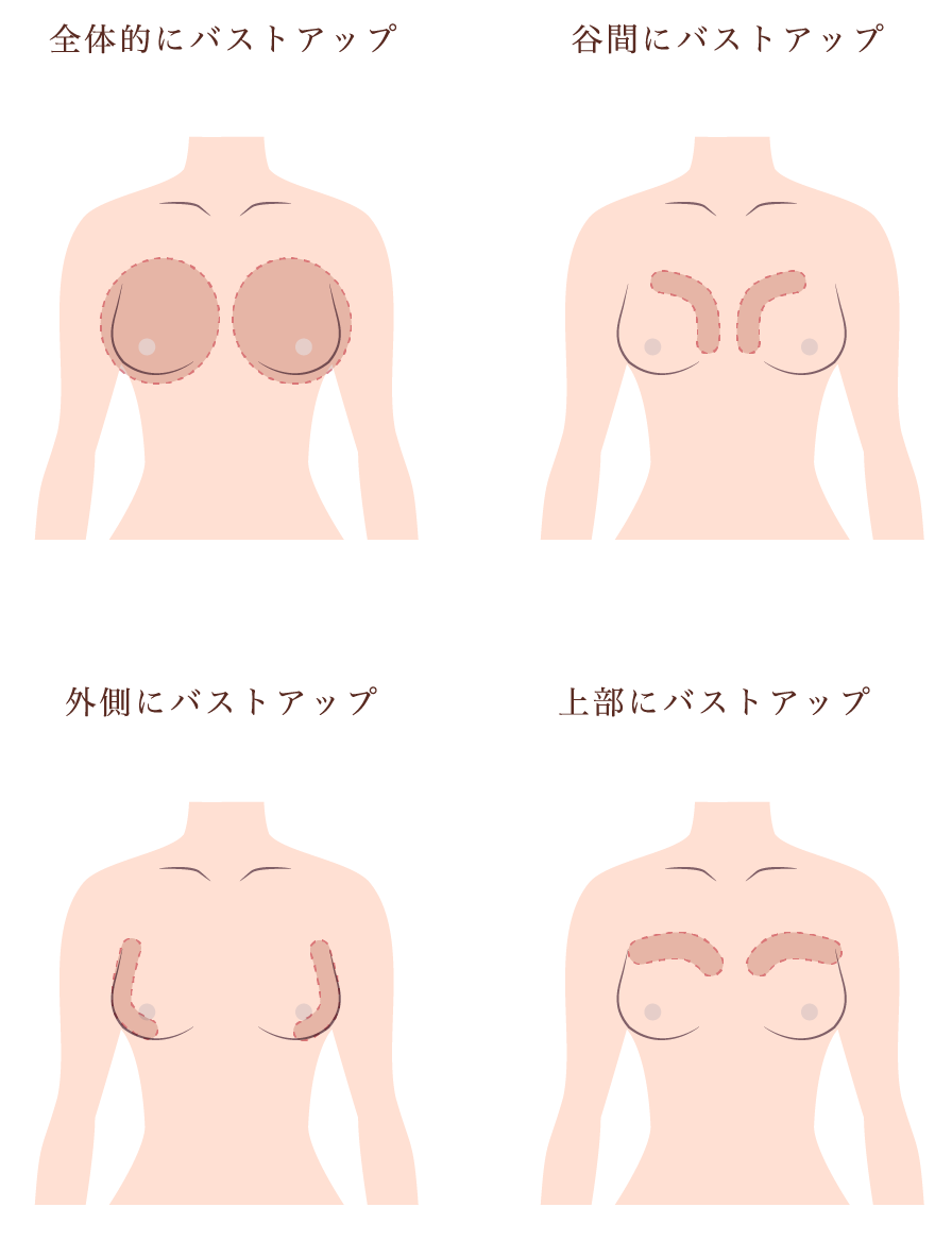 胸が小さくなった決定的な理由とは？産後・加齢の真相と元に戻す術