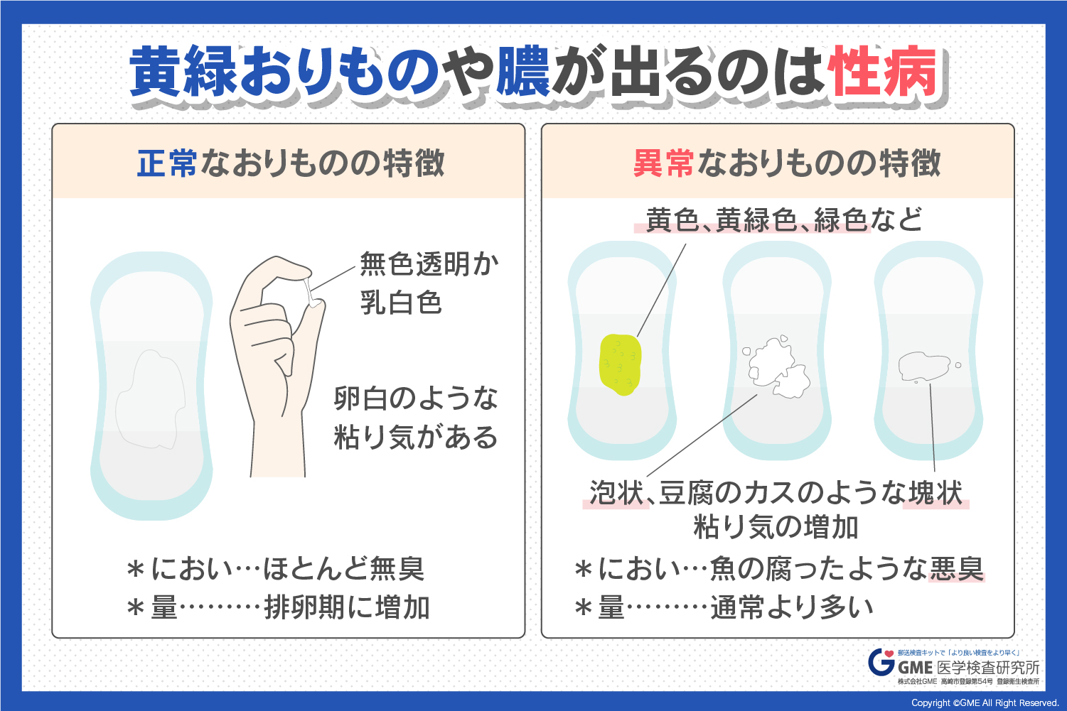 黄緑色のおりものは病気のサイン？原因と放置リスク・受診の目安を徹底解説