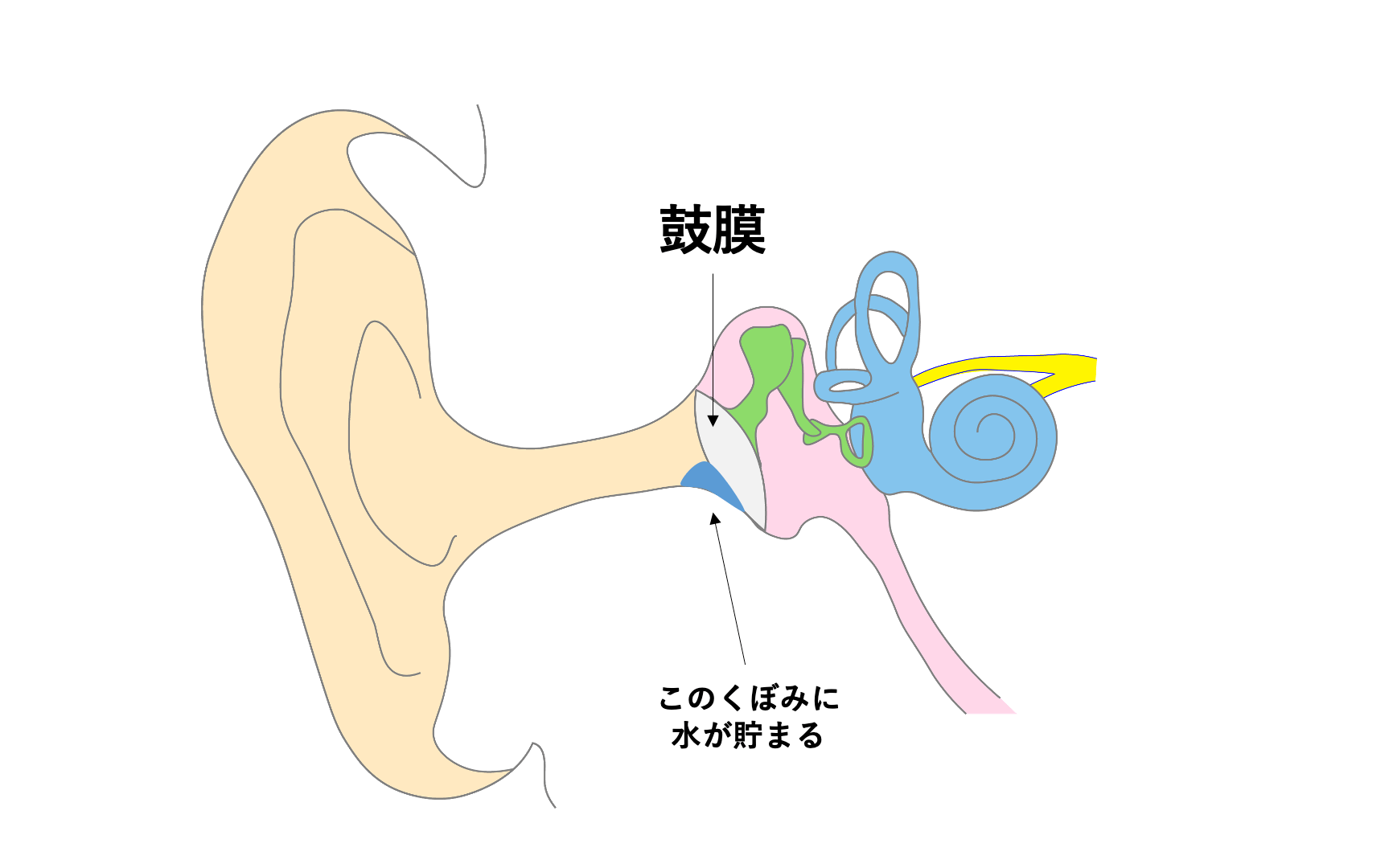 耳の水が抜けない時の出し方裏ワザ！綿棒Ngの真相と受診の目安