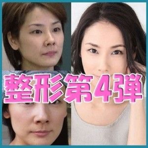 【噂】 目頭 切開 やりすぎ 芸能人 最新画像・動画まとめ #917
