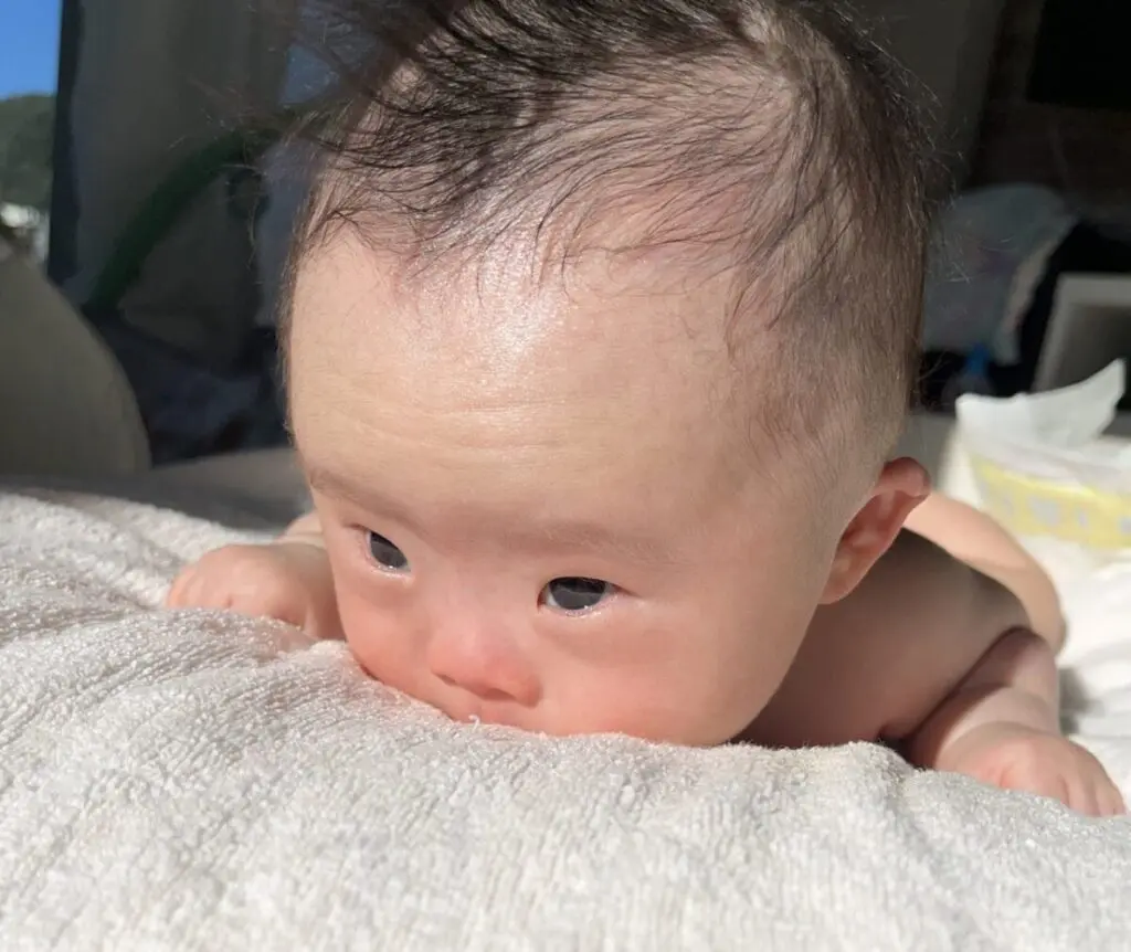 ダウン症はいつわかる？妊娠中の検査時期・エコーと出産後の確定診断