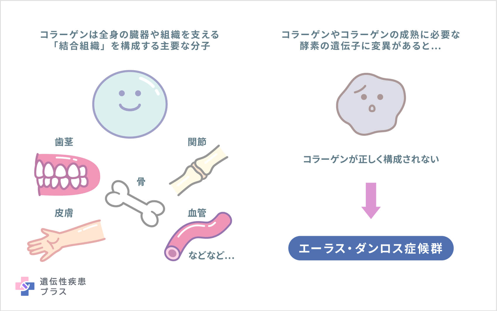 関節が異常に伸びる皮膚の正体｜エーラスダンロス症候群の診断と実態