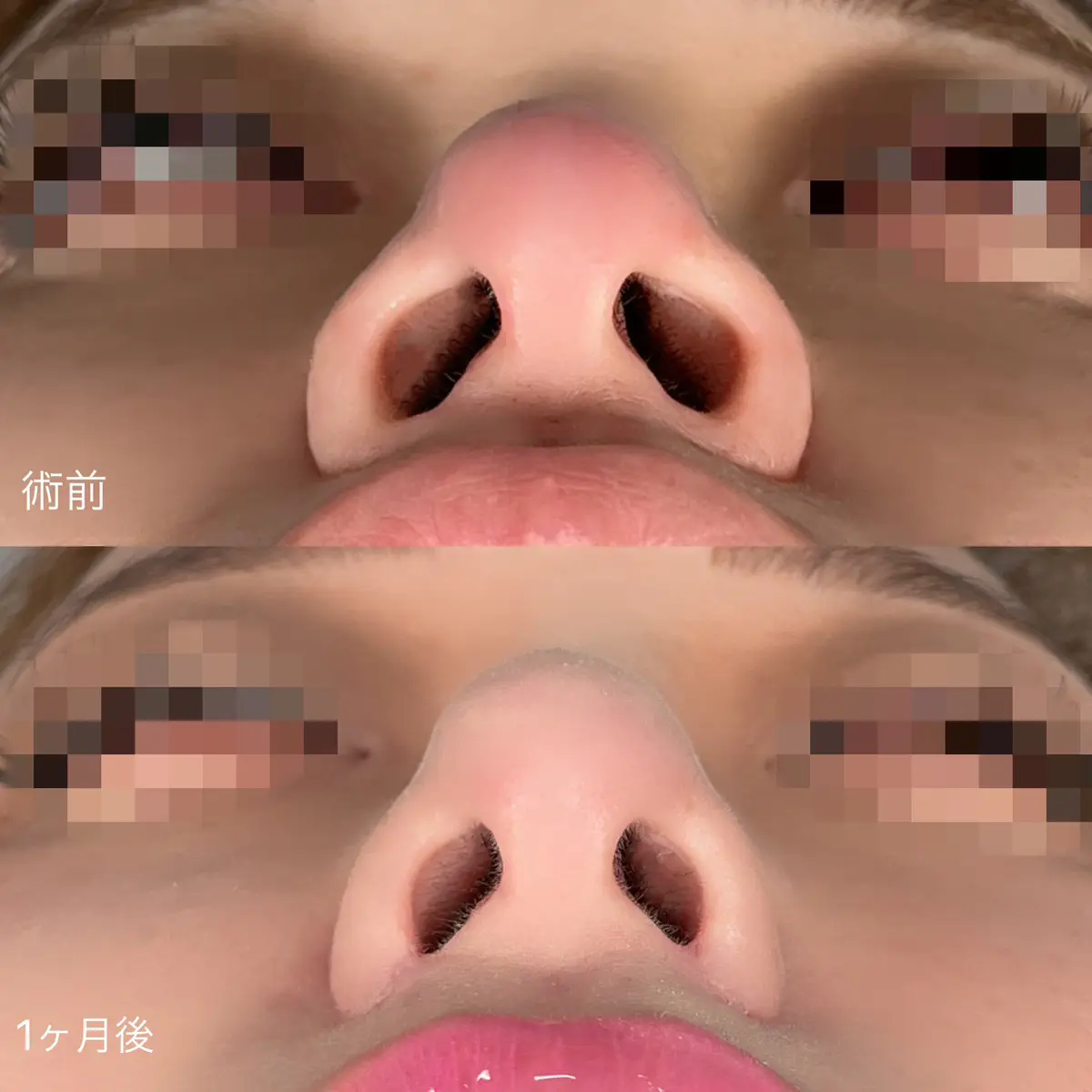 鼻の穴が大きい人の性格と人相学の真相｜原因と目立たなくする改善法