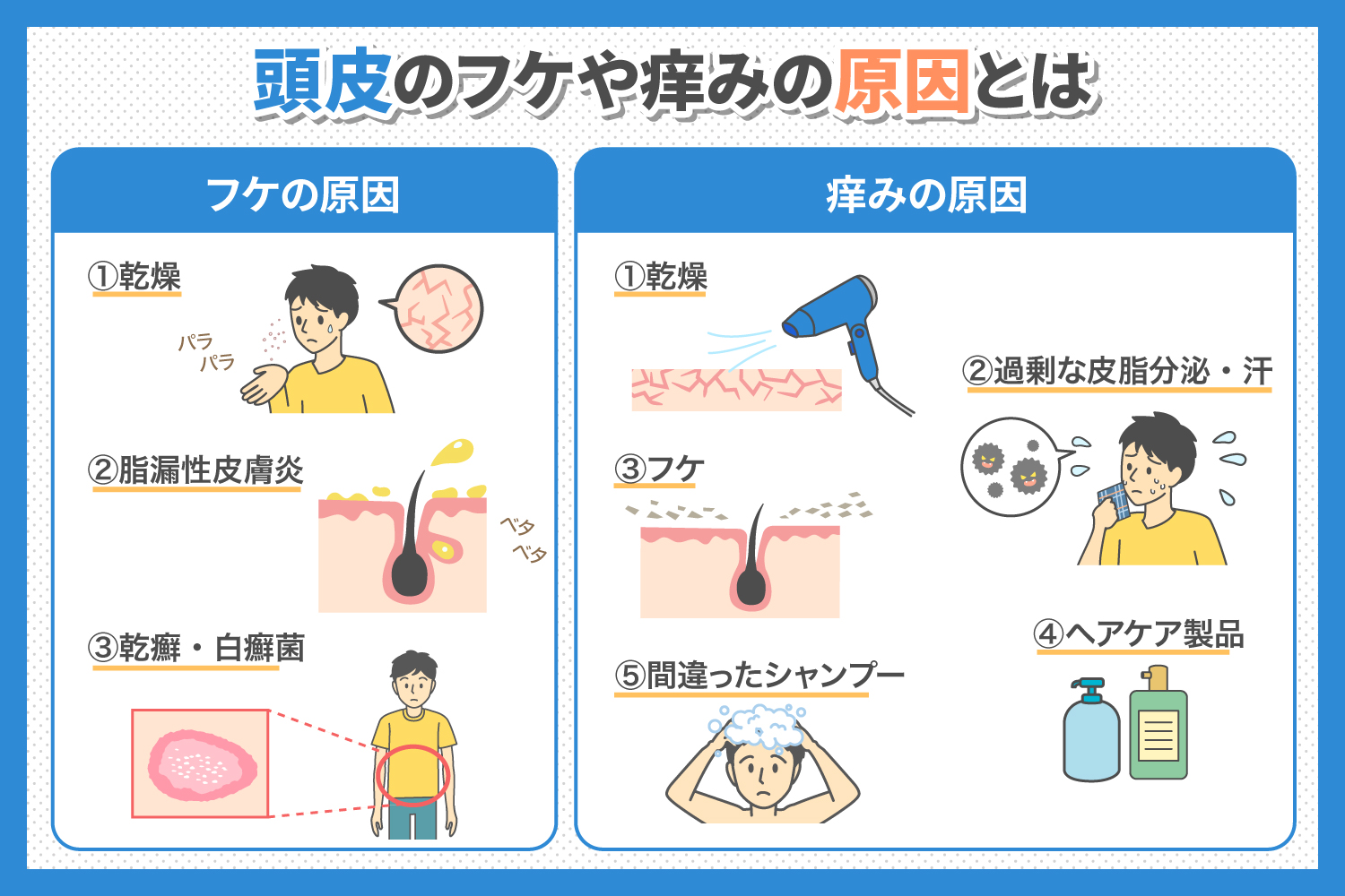 頭皮のかゆみとフケが治らない真相｜2026年最新の改善策とNg習慣