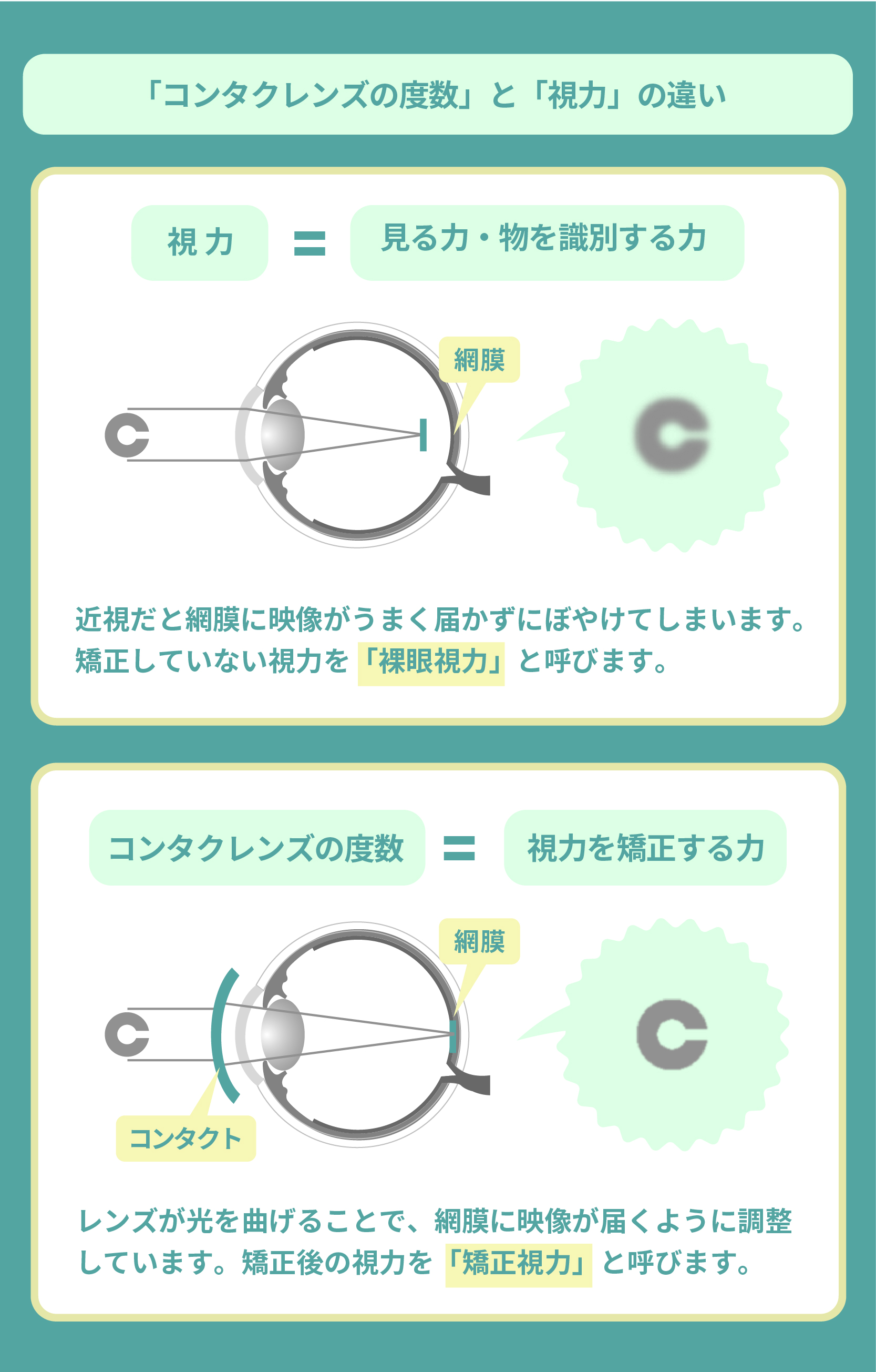 コンタクトが取れない時の安全な外し方｜張り付きや目の裏の緊急対処法