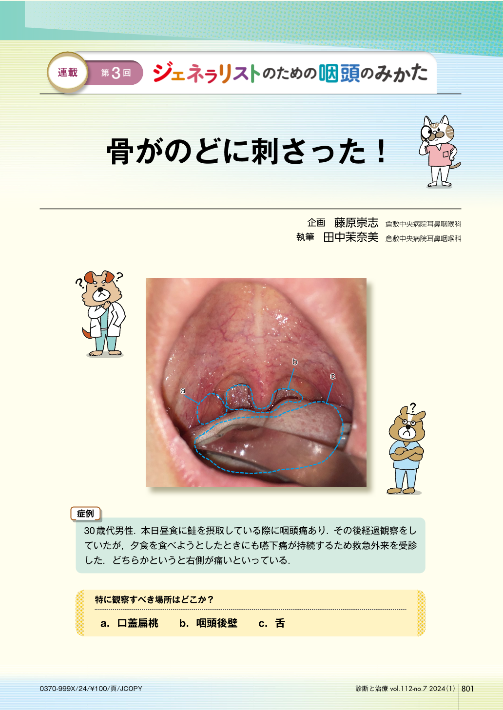 喉に魚の骨が刺さった時の正しい取り方と受診目安｜ご飯丸呑みは超危険？