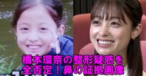橋本環奈の「顔の変化」を徹底検証：2026年最新の整形疑惑と、私たちが「奇跡の美貌」に抱く幻想の正体