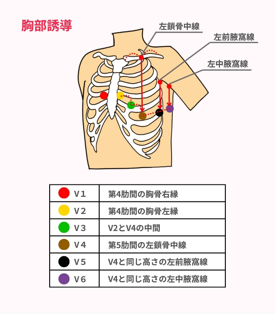 十二誘導心電図の貼り方と読み方完全攻略！波形異常を見逃さない現場の鉄則