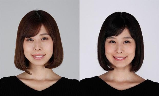 有村藍里が告白した骨切り手術の全貌！劇的な変化と現在の心境