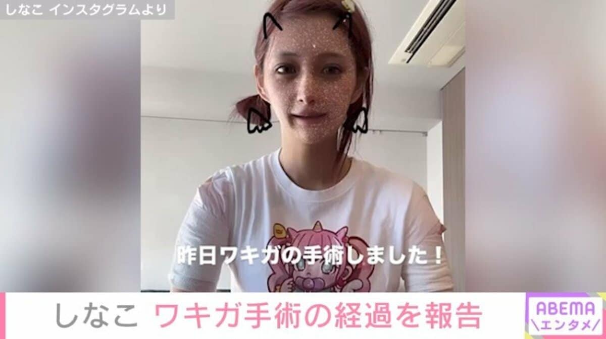 ワキガ手術を公表した芸能人と噂の真相！傷跡や2026年最新治療を徹底解剖