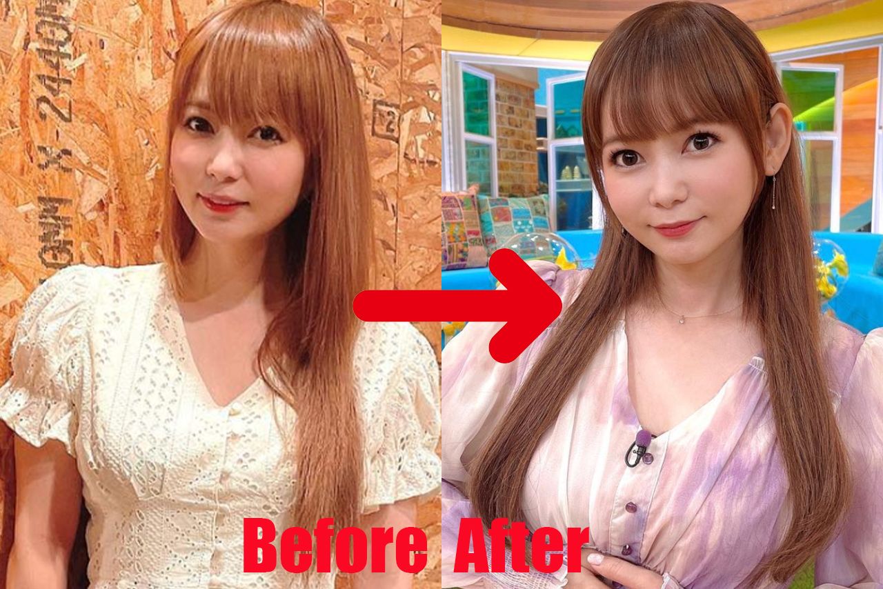 しょこたんの顔が変わった？昔と現在の画像を徹底比較検証