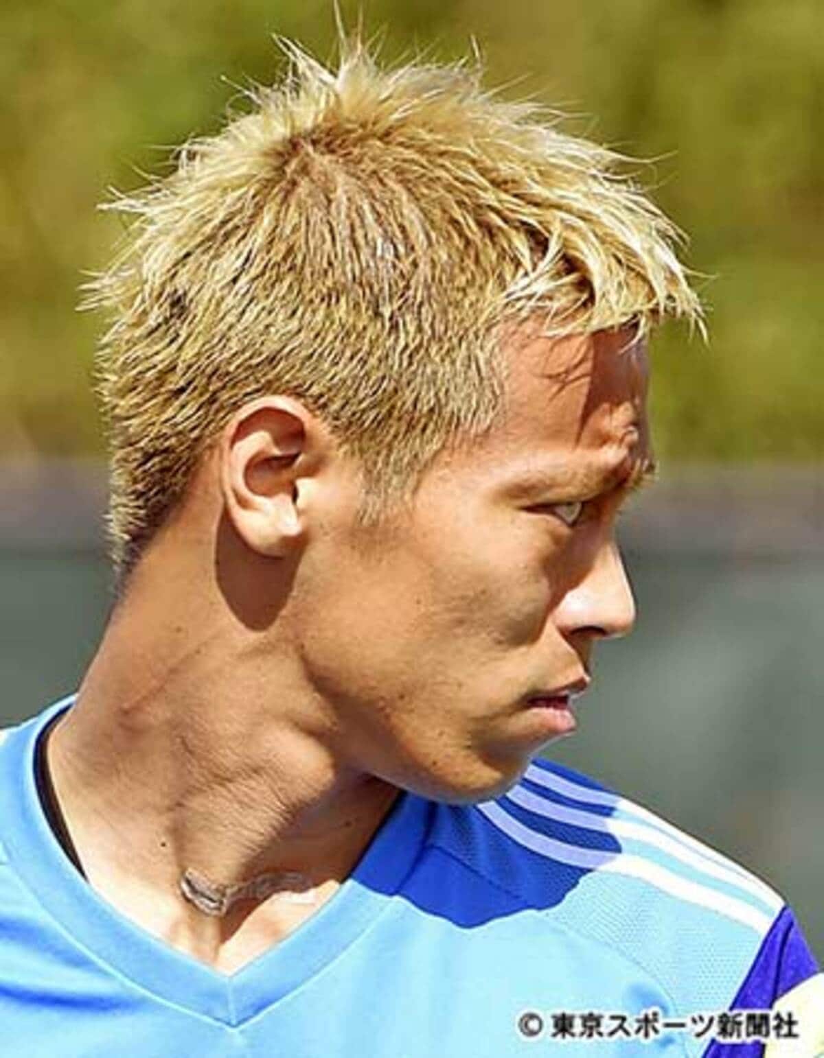 本田圭佑のバセドウ病疑惑と首の傷跡｜目の変化と2026年の真相