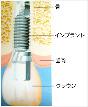 【熱愛】 吉田正尚 歯 インプラント 話題のSns投稿まとめ 2026 #835