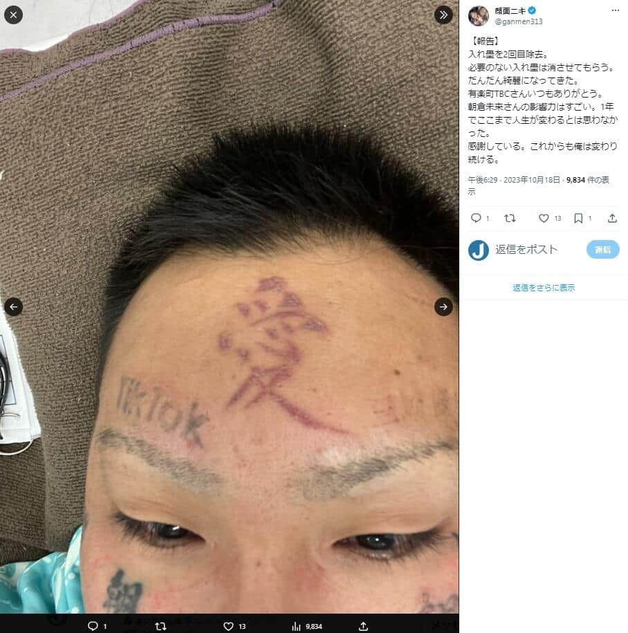 朝倉未来のタトゥー疑惑の真相！本物かシールか入れない理由を徹底解剖