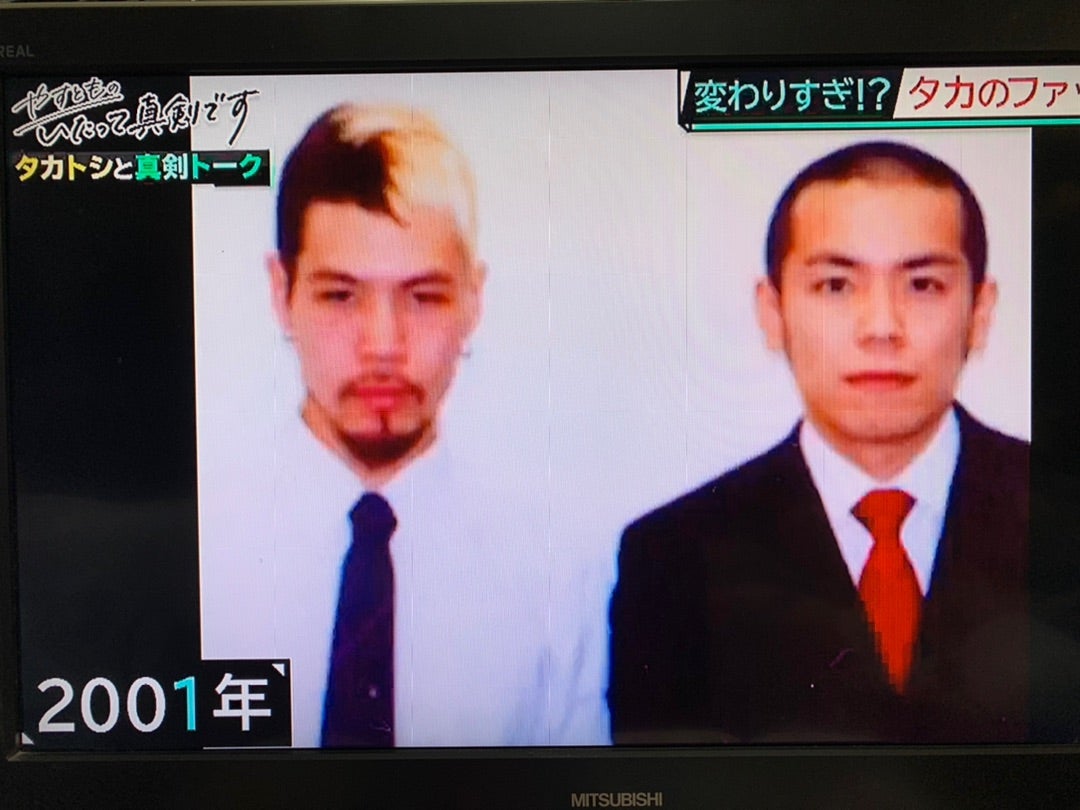タカアンドトシ・タカの昔が超絶イケメン！激変の真相と現在を徹底追跡
