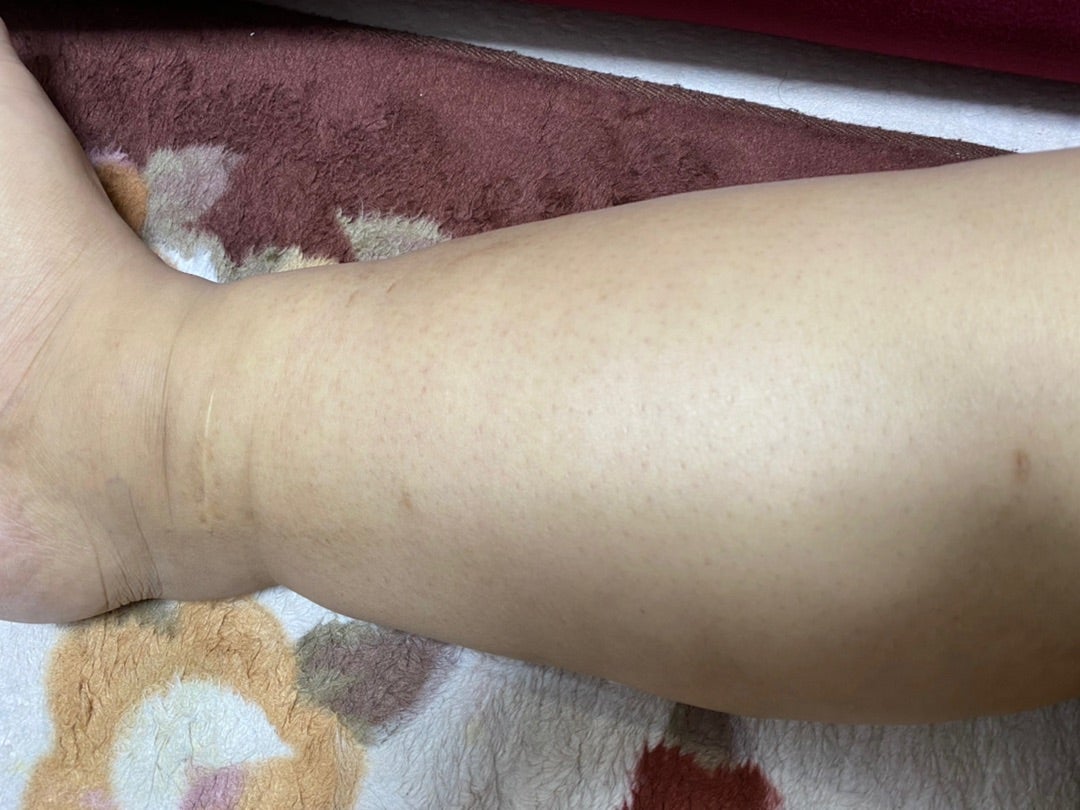 肝硬変闘病記の真実｜余命宣告と末期の苦痛から生還する分岐点