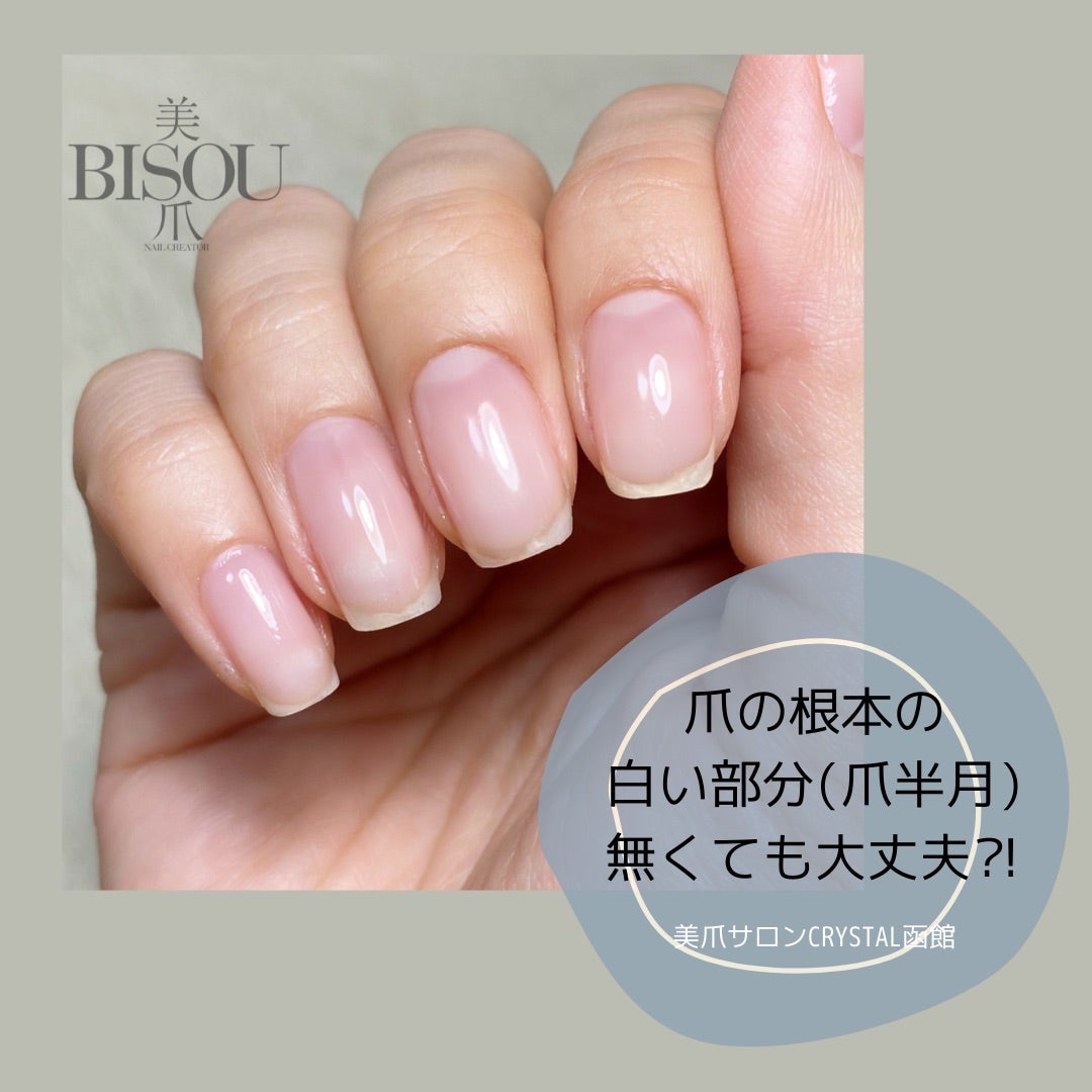 爪の白い部分がないのは病気？爪半月の真相と健康リスクを徹底解明