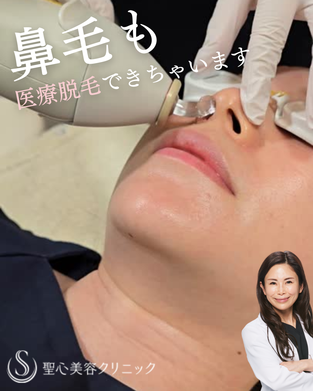 鼻毛の医療脱毛で後悔しない？痛み・効果回数と照射範囲の真相【2026年最新】