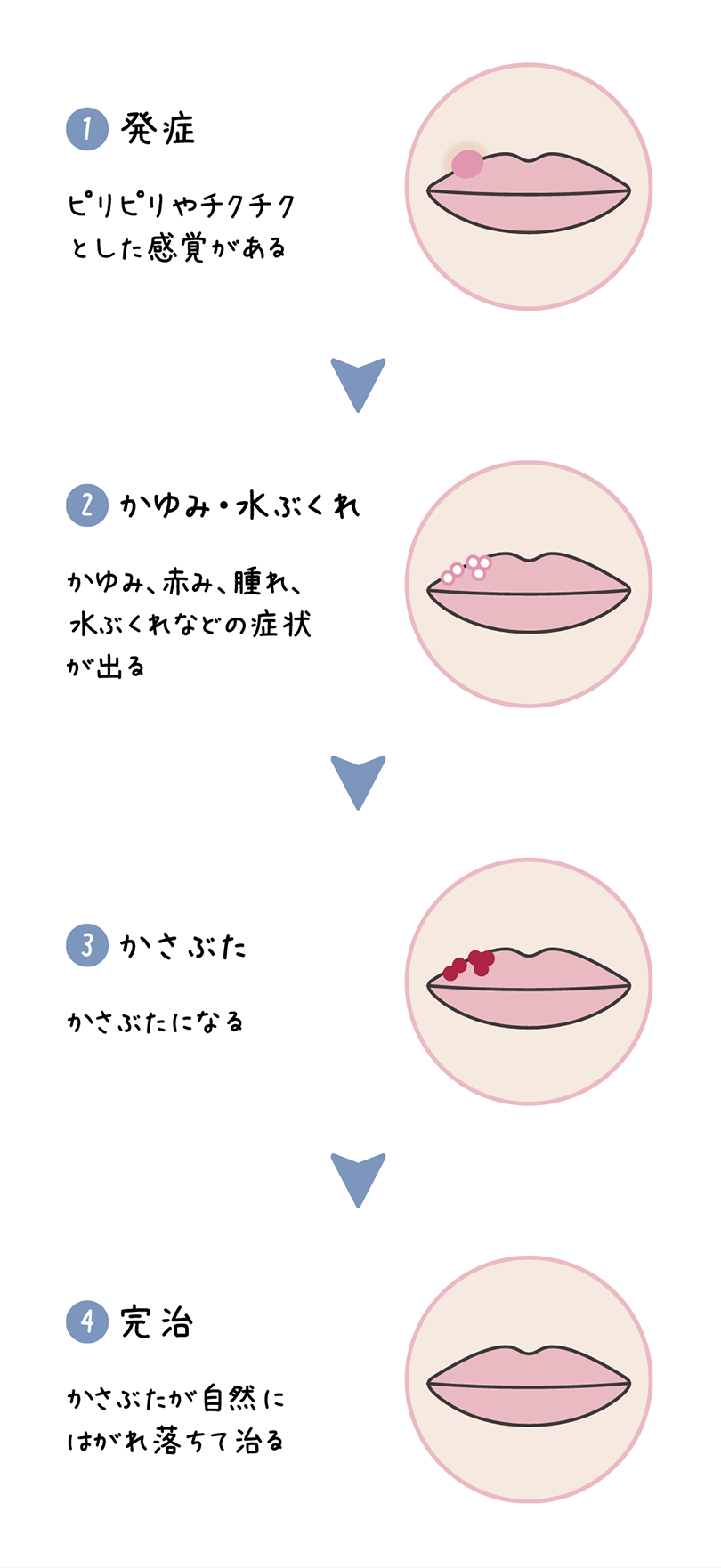 ヘルペスとは？ピリピリする初期症状の原因と2026年最新治療法