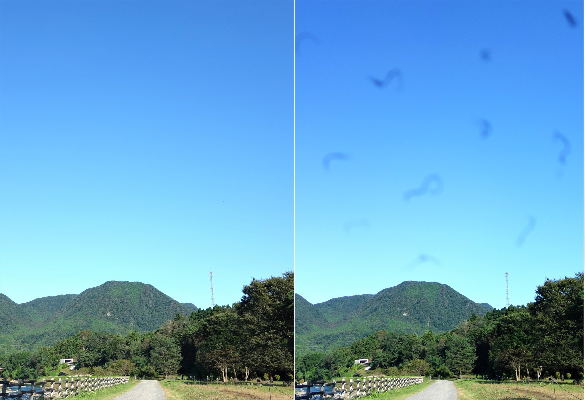視界に黒い影が突然現れる原因とは？網膜剥離と飛蚊症の危険な見分け方