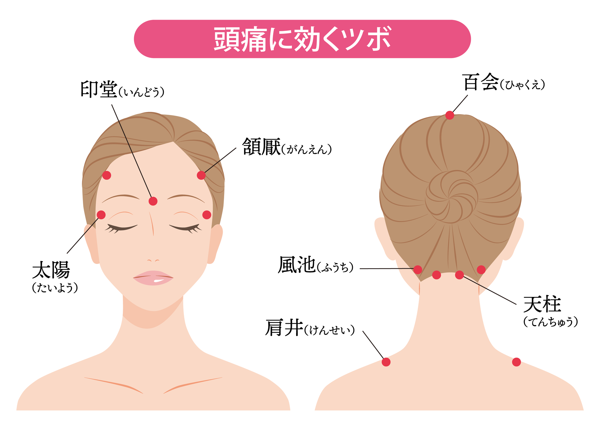 偏頭痛に効くツボと即効の治し方｜押してはいけない危険な理由