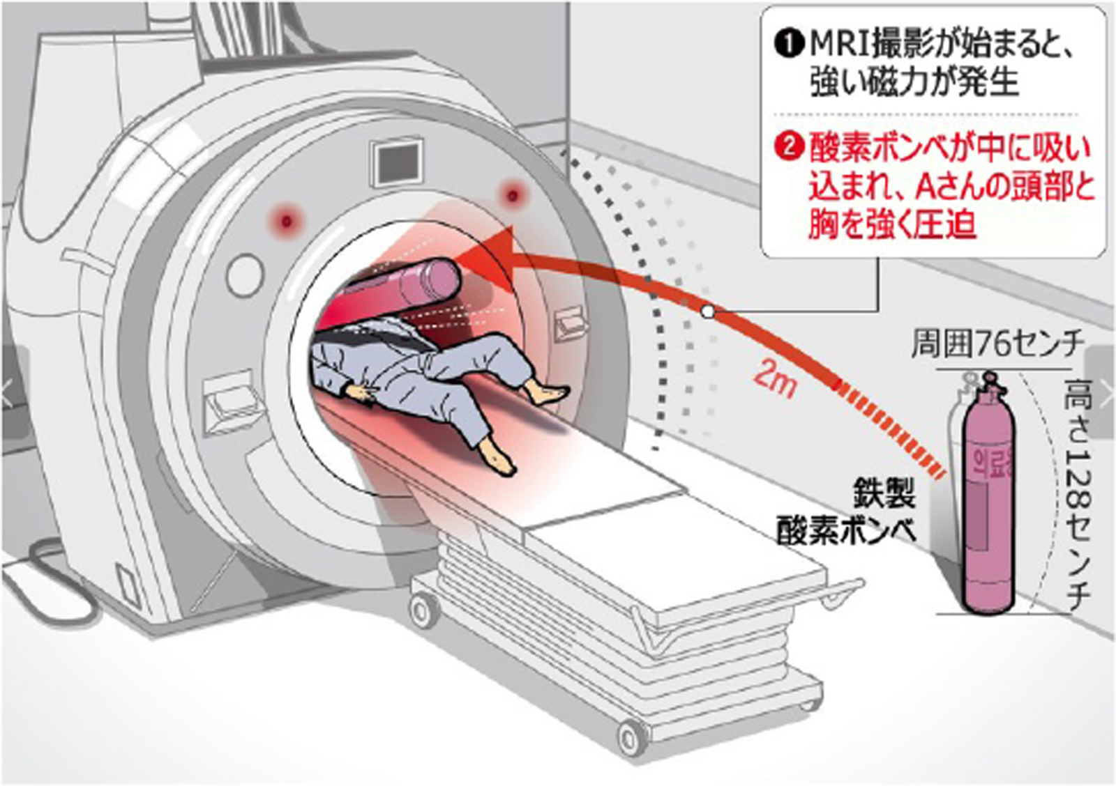 Mri金属事故の真相｜酸素ボンベ吸着や死亡事例の教訓と必須の安全対策