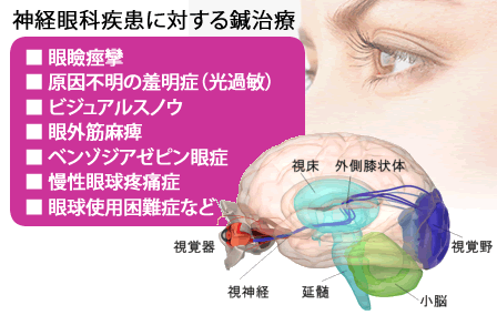 【速報】 眼球 使用 困難 症 最新熱愛噂まとめ #824
