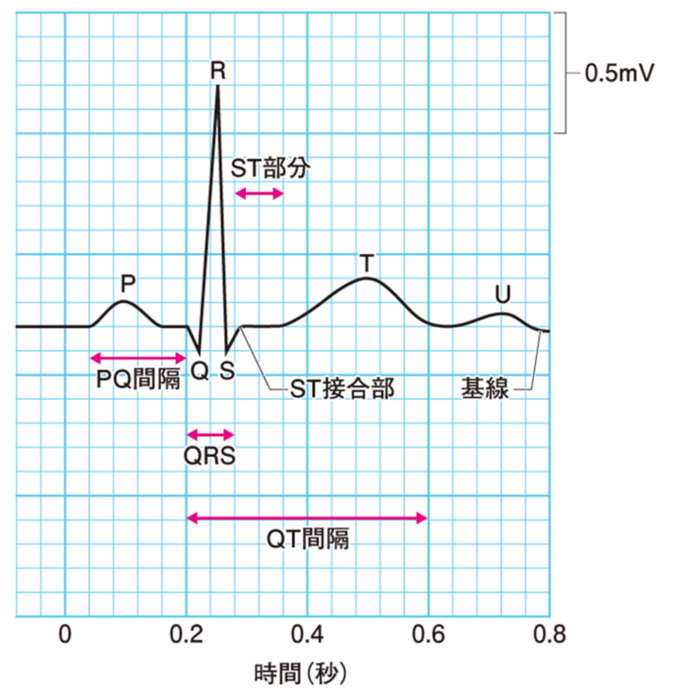 狭心症なのに心電図で異常なし？見落としを防ぐ検査の真相を徹底解説