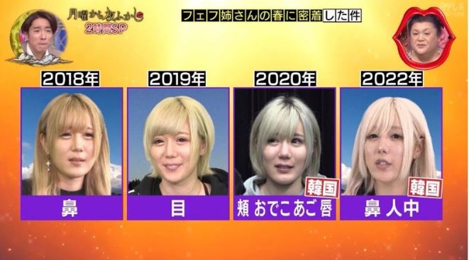 【話題】 多田 さん 整形 前 最新情報まとめ 2026 #937