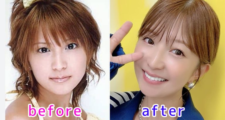 矢口真里の整形疑惑の真相！アイプチ公言と昔と現在の顔変化を徹底検証